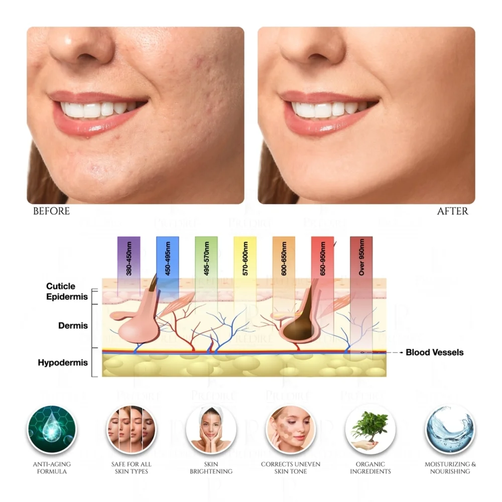 P RÉVENCE Gold LED Face Mask - Picture 6 of 9